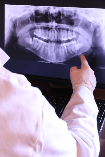 Best Emergency Tooth Extraction in Lyons, IL